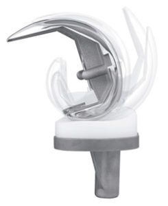 Freedom Partial Kneed