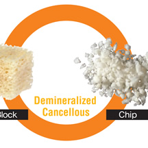 D-Sure™ Block and Chip (Genesis Sponge)