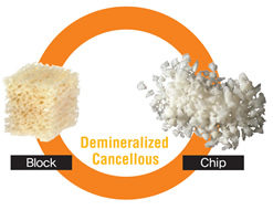 D-Sure™ Block and Chip (Genesis Sponge)