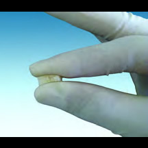 D-Sure™ Block and Chip (Genesis Sponge)