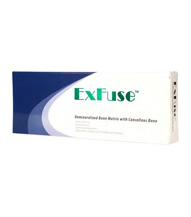 ExFuse