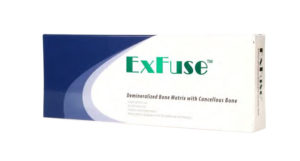 ExFuse