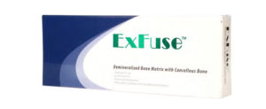 ExFuse