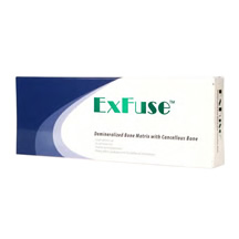 ExFuse