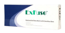 ExFuse