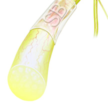 Amniofix (non frozen)