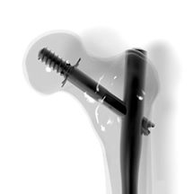 Talon Lag Screw
