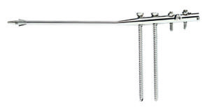 Fibulock (fibula)