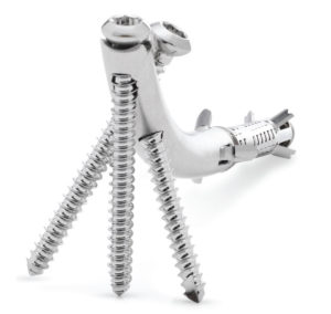 WRx (wrist/distal radius)